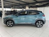 Hyundai Kona bei Sportwagen.expert - Abbildung (3 / 15)